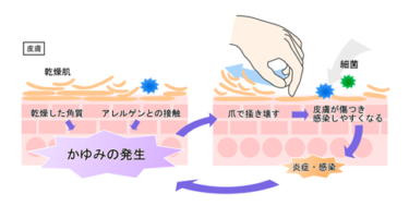 【冬の対策】頭皮の乾燥・かゆみ・どこにも載ってないお手入れ方法
